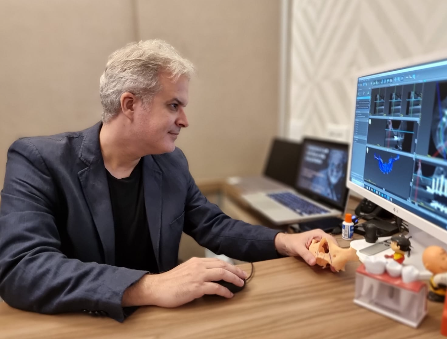 Planejamento digital do caso sobre a tomografia