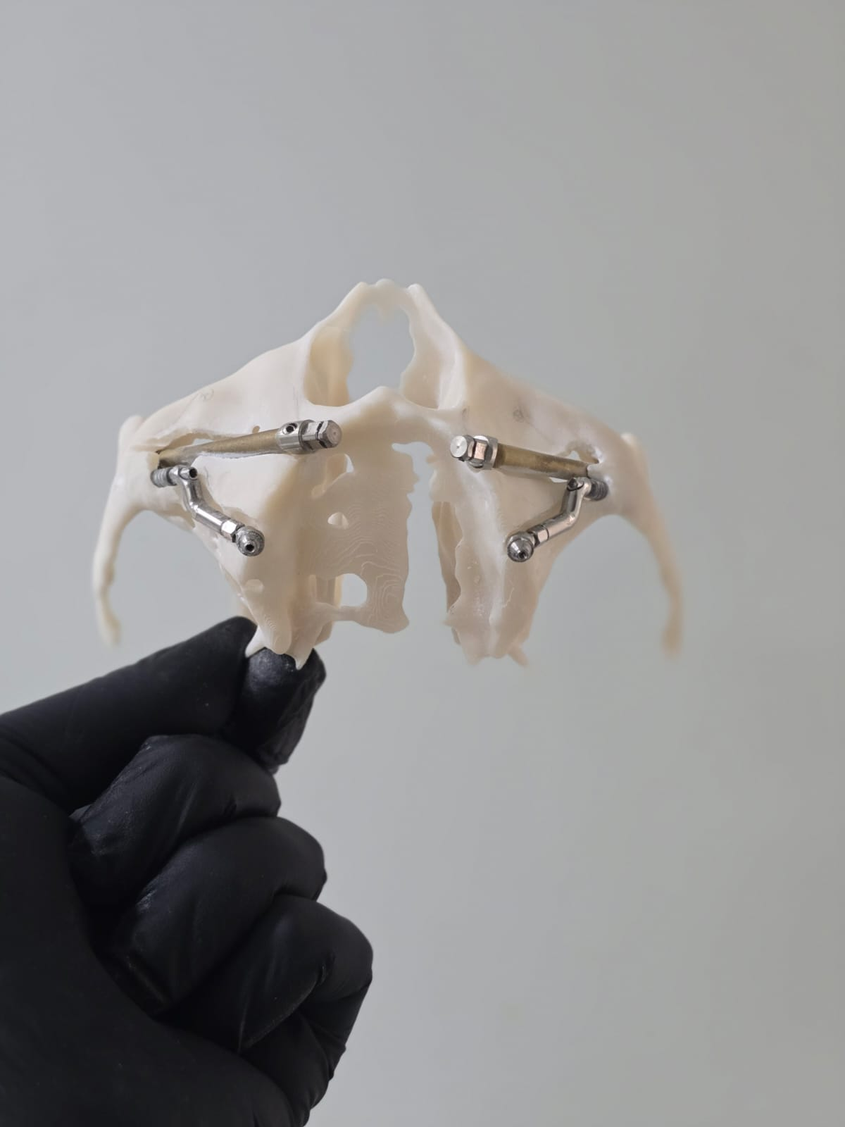 Protótipo impresso da maxila com implantes para ensaio